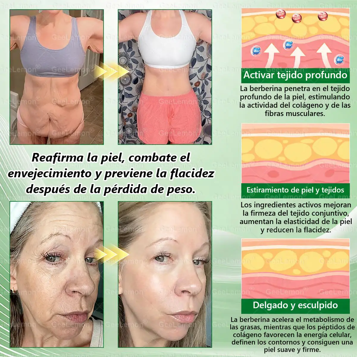 🔥𝐆𝐞𝐞𝐋𝐞𝐦𝐨𝐧® 𝐌𝐨𝐫𝐢𝐧𝐠𝐚 · 𝐁𝐞𝐫𝐛𝐞𝐫𝐢𝐧𝐚 × 𝐍𝐀𝐃+ 𝟏𝟎 𝐞𝐧 𝟏 𝐏𝐚𝐫𝐜𝐡𝐞 𝐀𝐯𝐚𝐧𝐳𝐚𝐝𝐨 𝐝𝐞 𝐍𝐚𝐧𝐨-𝐌𝐢𝐜𝐫𝐨𝐚𝐠𝐮𝐣𝐚𝐬👩⚕️🇺🇸 (Solo una vez al día, cambios visibles en 7 días) ✅ Para la obesidad, la flacidez de la piel, la diabetes y más.