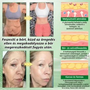 💎💎💎GeeLemon® Glumasetide 8az 1-ben Karcsú és EgészségesNano Mikrotűs Tapasz (Napi 1alkalom – látható változásakár 7 nap alatt) ✅ Elhízásra,bőrfeszesítésre,cukorbetegségre, alvásiapnoéra, ízületekre stb