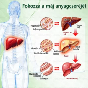 💎💎💎GeeLemon® Glumasetide 8az 1-ben Karcsú és EgészségesNano Mikrotűs Tapasz (Napi 1alkalom – látható változásakár 7 nap alatt) ✅ Elhízásra,bőrfeszesítésre,cukorbetegségre, alvásiapnoéra, ízületekre stb
