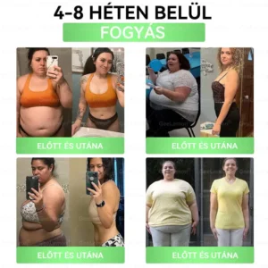 💎💎💎GeeLemon® Glumasetide 8az 1-ben Karcsú és EgészségesNano Mikrotűs Tapasz (Napi 1alkalom – látható változásakár 7 nap alatt) ✅ Elhízásra,bőrfeszesítésre,cukorbetegségre, alvásiapnoéra, ízületekre stb