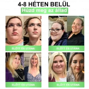 💎💎💎GeeLemon® Glumasetide 8az 1-ben Karcsú és EgészségesNano Mikrotűs Tapasz (Napi 1alkalom – látható változásakár 7 nap alatt) ✅ Elhízásra,bőrfeszesítésre,cukorbetegségre, alvásiapnoéra, ízületekre stb