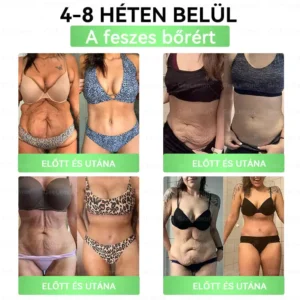 💎💎💎GeeLemon® Glumasetide 8az 1-ben Karcsú és EgészségesNano Mikrotűs Tapasz (Napi 1alkalom – látható változásakár 7 nap alatt) ✅ Elhízásra,bőrfeszesítésre,cukorbetegségre, alvásiapnoéra, ízületekre stb