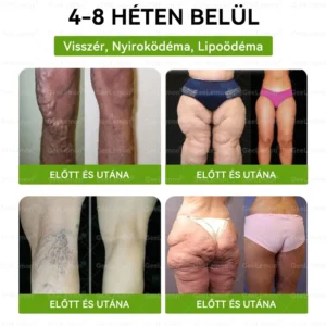 💎💎💎GeeLemon® Glumasetide 8az 1-ben Karcsú és EgészségesNano Mikrotűs Tapasz (Napi 1alkalom – látható változásakár 7 nap alatt) ✅ Elhízásra,bőrfeszesítésre,cukorbetegségre, alvásiapnoéra, ízületekre stb